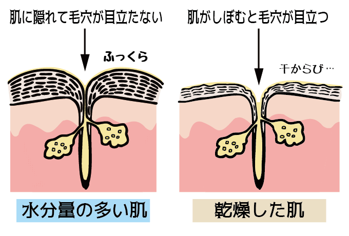 黒ずみのNGケアに注意!